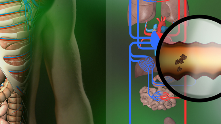 Vorschaubild für Human Liver