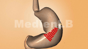 Animiertes Vorschaubild für Der Magen