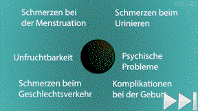 Animiertes Vorschaubild für Weibliche Genitalverstümmelung/ -beschneidung